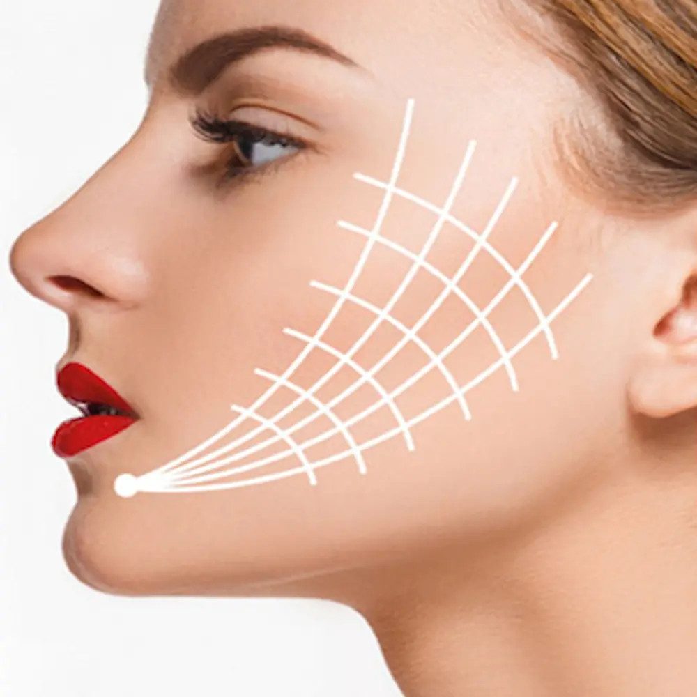 Das Fadenlifting ist die moderne Alternative zum klassischen Facelift – ganz ohne Operation. Mit innovativen, resorbierbaren PDO - Fäden.