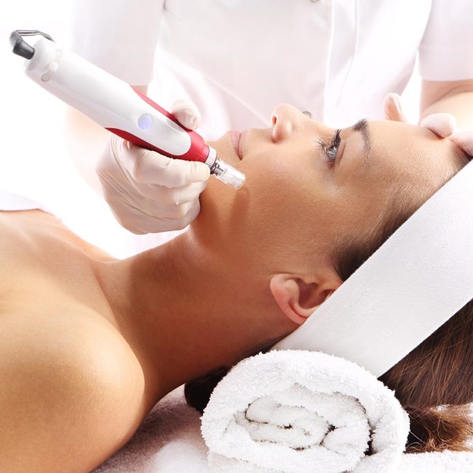 Bild einer Microneedling-Behandlung